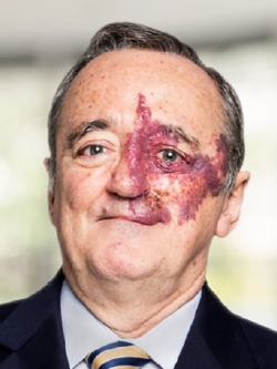 Mariano Barbacid (Premio Nacional de Investigación Santiago Ramón y Cajal, y jefe del Grupo de Oncología Experimental en CNIO.)